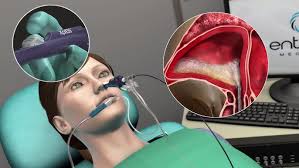 Meet Dr. Mark Mount, Ears, Nose & Throat