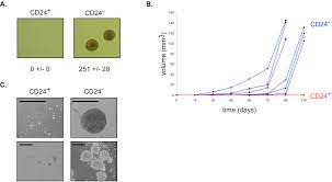 Gold) ductal carcinoma in situ / dcis. Plos One Generation Of Breast Cancer Stem Cells Through Epithelial Mesenchymal Transition