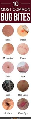 Bug Bites That Look Like Mosquito Bites But Hurt 10 Bug Bites Anyone Should Be Able To Identify Bug Bites Itchy Bug Bites Insect Bites