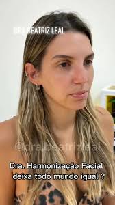 Transformação com Harmonização Facial pela Dra. Beatriz Leal