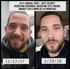 Sherri Williamson Rodan+Fields Consultant