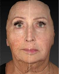 Prendre soin de sa peau, c'est s'offrir une dose d'amour au quotidien. Des  bienfaits qui se voient et se ressentent! À la Clinique D Esthétique, nous  vous proposons des traitements adaptés à