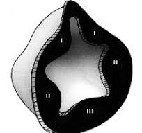 The new face seal attached to inside perimeter of a cup ...