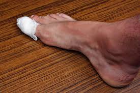 It is not a very common condition but it is very distressing when it occurs. Toenail Falling Off What To Do Causes And Removal