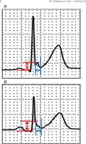 Image result for J Wave