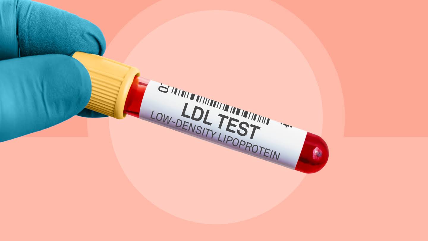 LDL product image