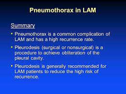 This air pushes on the outside of your lung and makes it collapse. Complications Related To Pneumothorax And Chylous Fluid Accumulation Ppt Video Online Download