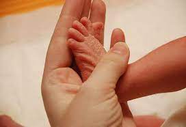 The fat in the moisturizer forms a thin layer on the skin, which replenishes and prevents further loss of moisture. Dry Skin In Infants Reasons Home Remedies