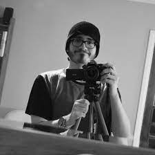 When to see a doctor for hair loss. Should Cdtv Productions Show His Hair Cdtvproductions Amino