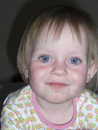 Helena (2) fikk GHB-sjokk