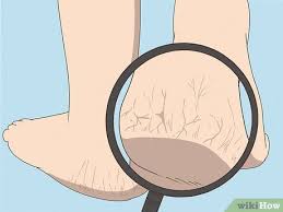 Feeling cold or difficulty staying warm How To Tell If Your Metabolism Is Slowing With Pictures