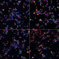 Auswerfen von mit proteinen umhüllten strängen (=net) aus granulären proteinen und nukleären bestandteilen Redes Letais Revista Pesquisa Fapesp