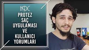 Protez Sac Uygulamasi Ve Kullanici Yorumlari Hdc Youtube