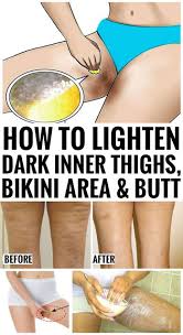 Just take the potato and extract its juice. Home Remedies To Lighten Dark Inner Thighs Butt And Bikini Area Wellness Days