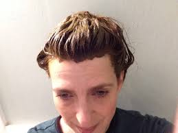 Allergies are nothing to sneeze. Self Care Ideas Henna Hair Dye