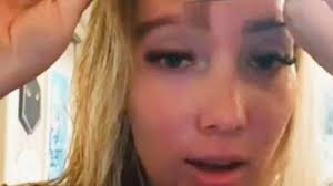 Woman's eyebrow transplant grows so long she has to trim and 'style' them