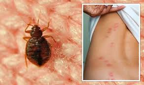Image result for bedbug bites look like
