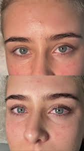 Hey ladies 🫶🏼 I'm taking