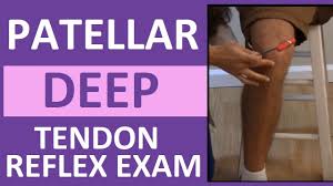 Image result for Reflex Exam