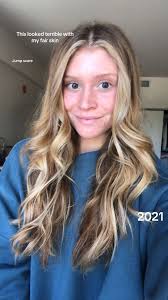 Did Alex Coopef Dye Her Hair