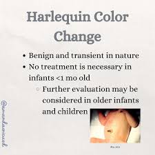 Image result for Harlequin Color Change