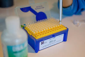They can simply reach out to the federal grants' official website or can visit the nearby office from where they can easily get the required assistance to receive a grant. Ucla Led Pancreatic Cancer Research Projects Receive 6 Million In Grant Funding Daily Bruin