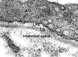Gels of polysaccharides and fibrous proteins fill the interstitial space and act as a compression buffer against the stress placed on the ecm. Matrix Proteoglycans As Effector Molecules For Epithelial Cell Function European Respiratory Society