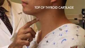 A cancer diagnosis is always worrisome, but even if a nodule turns out to be thyroid cancer, you still have plenty of reasons to be hopeful. Thyroid Exam Stanford Medicine 25 Stanford Medicine