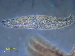 Image result for Protozoa
