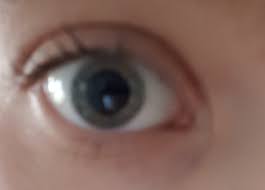 Sind Meine Pupillen Gross Oder Normal Gesundheit Und Medizin Drogen Augen