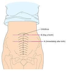 Postpartum Fundal Height Nurse Midwife Student Midwife Nursing Mnemonics