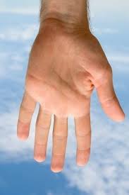 That blob of hand sanitizer you quickly smear onto your hands probably won't kill those cold and flu bugs. Soft Growths In The Palm Of Both Hands Get Rid Of Ringworm Treating Ringworm Ringworm