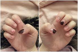 Gel nagel entfernen gepflegte nagel frag mutti. Kunst Vs Natur Wie Schadlich Sind Acrylnagel Und Gibt Es Alternativen Gesundheitstrends