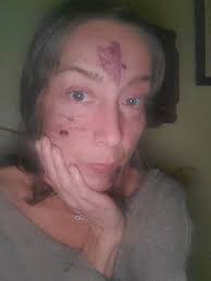 131 questions with answers in HIV/AIDS