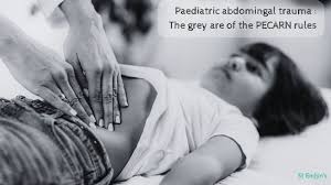 Image result for PECARN Pediatric Intra-Abdominal Injury Algorithm