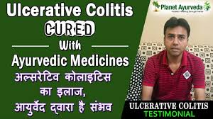 Repeat Ulcerative Colitis Cured With Ayurvedic Medicines