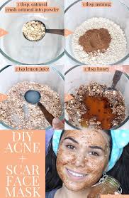 Best DIY Face Mask for Acne & Scars