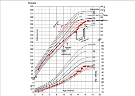 Growth Chart Of Patient National Center Of Health