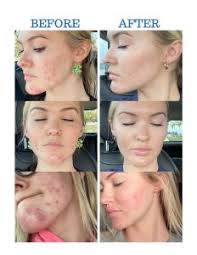 The Laser Lounge Spa