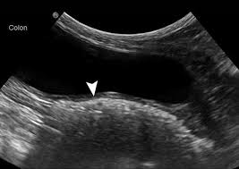 For example, a bone tumor (osteosarcoma) might cause a limp, or a bladder tumor the good news is, not all of these signs point to cancer. Ultrasonography Of The Gastrointestinal Tract Ileum Cecum Colon Today S Veterinary Practice