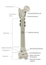 Benign and malignant bone tumors are relatively rare. Benign Bone Tumors Knowledge Amboss
