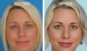 Join me as i share with you my personal experience of trying out under eye permanent makeup. Permanent Makeup Under Eyes Saubhaya Makeup