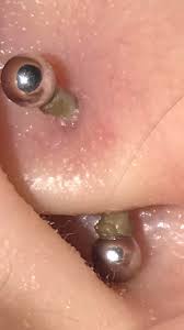 How To Heal Nipple Piercing Crusties + Are They Normal?
