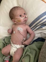 My NICU guy with Pierre Robin Sequence/cleft palate- 2 days old, 10 days,  14 weeks. The difference a couple months makes! : r/NICUParents