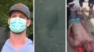Combat in shark attack deathmatch 2 is savage, gritty and brutal. Santa Rosa Man Says He Ll Likely Get Back In The Water Despite Being Bitten 6 Times In Miami Shark Attack Abc7 San Francisco