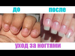 как отрастить ногти за 1 час в домашних условиях Kak Otrastit Nogti Za 3 Dnya Uhod Za Nogtyami Ukreplenie Nogtej Withme Stayhome Youtube