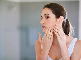 8 Cara Menghilangkan Jerawat Dengan Bahan Alami