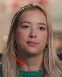 After seeing episode 2, can someone tell me how Baylen sister got that scar 