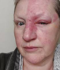 Ophthalmologist recommendation needed urgently