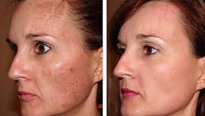 Image result for à¤¦à¤¾à¤-à¤§à¤¬à¥à¤¬à¥ à¤à¥ à¤¦à¥à¤° à¤à¤°à¥